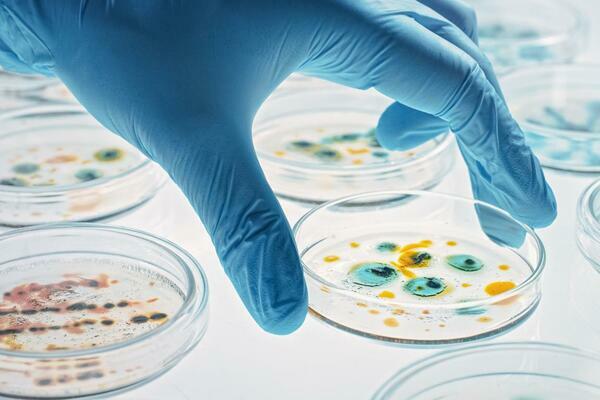 agar plates in the laboratory agar plates in the laboratory